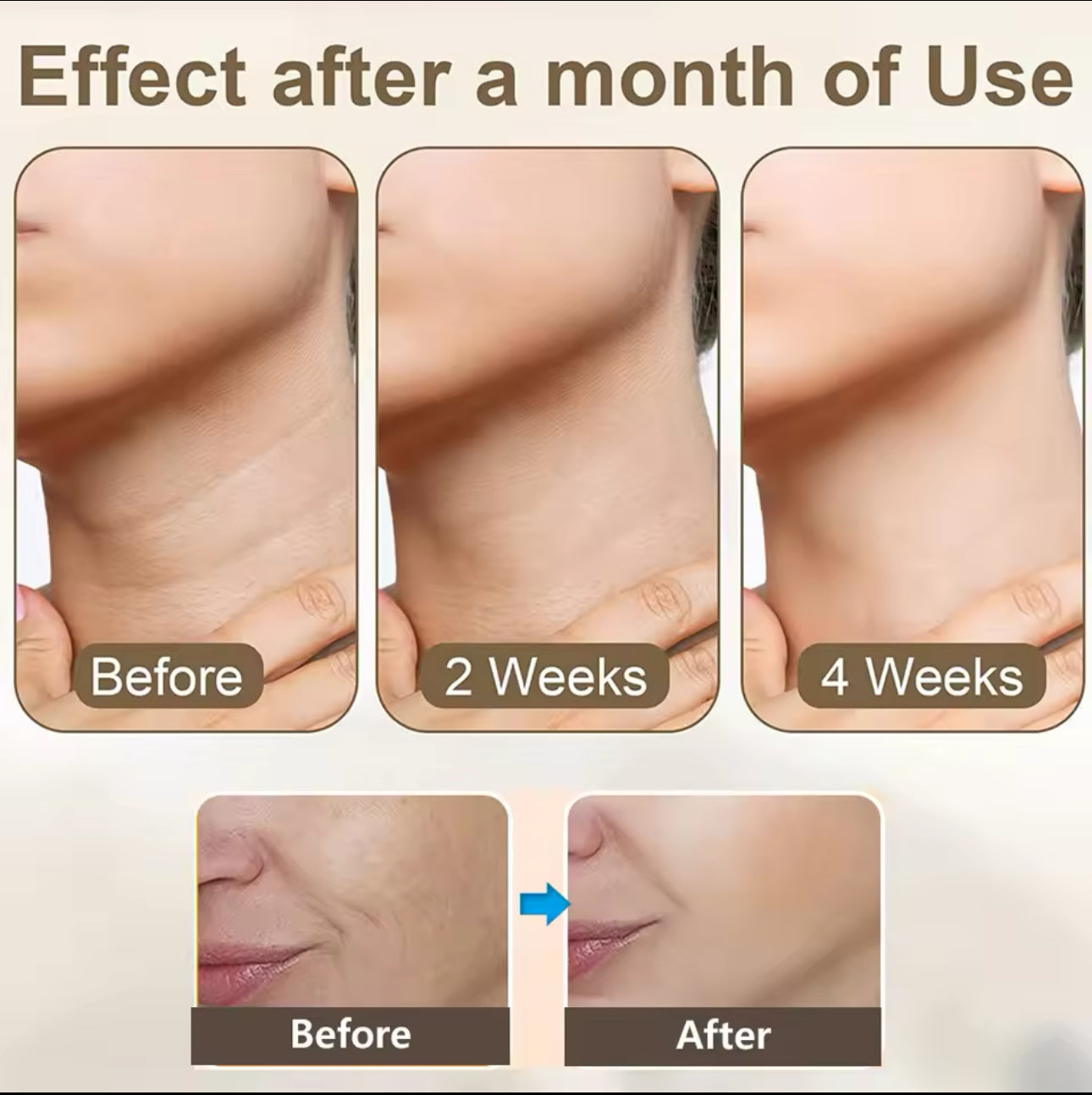 Double Chin Remover | Wrinkle Removal | LED Light Therapy | Skin Lift & Tightening™